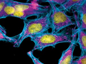 El cultivo de células HeLa ha supuesto uno de los mayores descubrimientos en biomedicina y genética